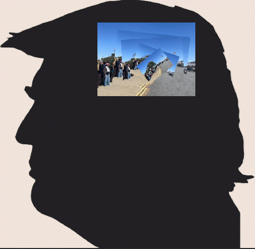 Trump's brain 